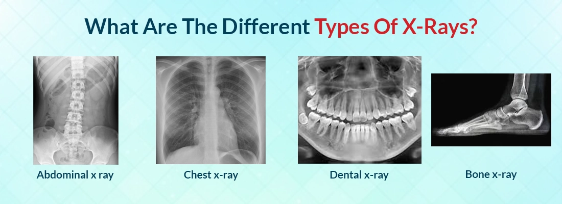 Types of X Rays 